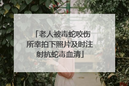老人被毒蛇咬伤 所幸拍下照片及时注射抗蛇毒血清